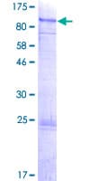 Human PIAS3 Protein (Recombinant GST)