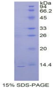 Rat PK2 / PROK2 Protein (Recombinant His)