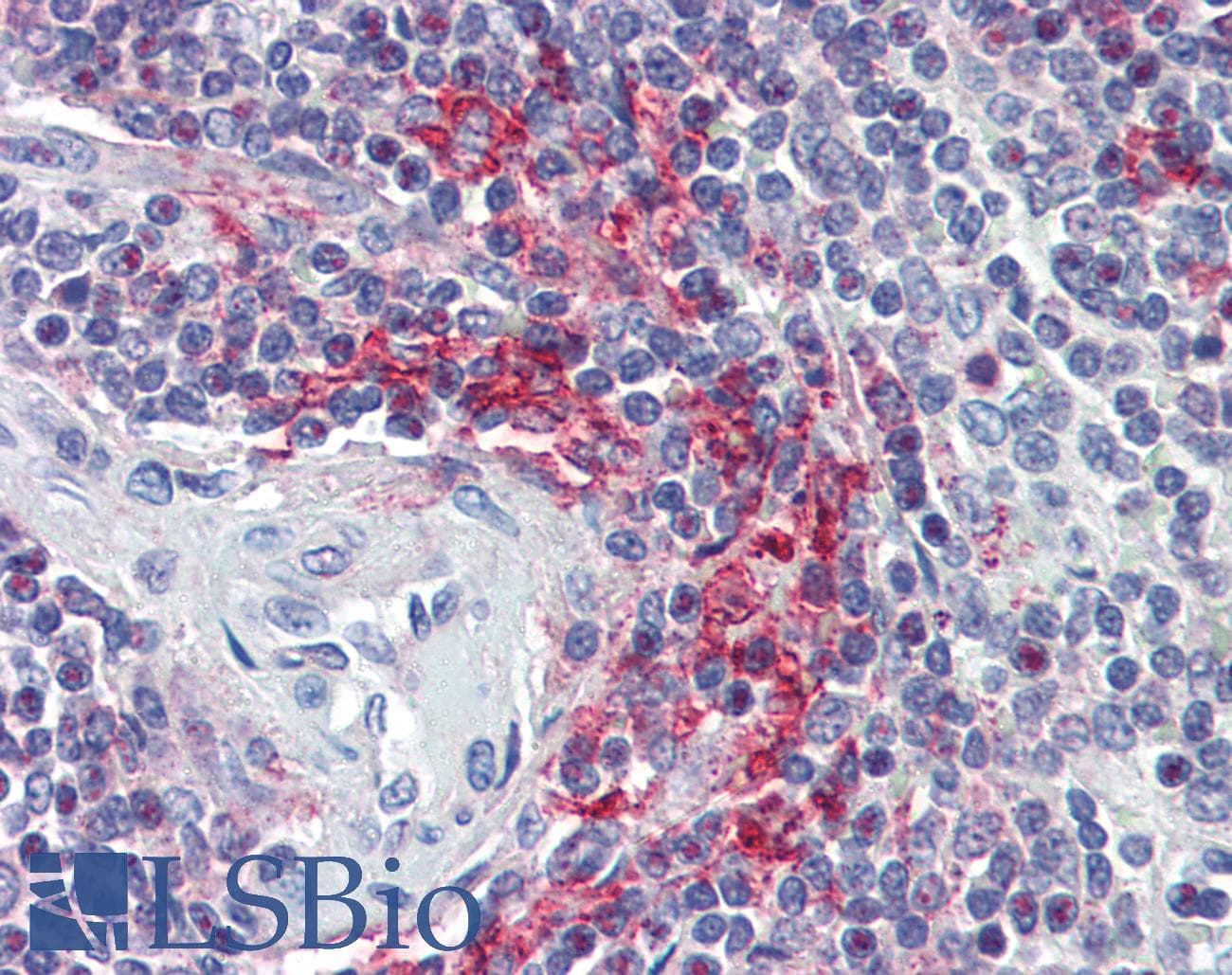 IHC-plus™ Polyclonal Goat anti-Human VAV3 Antibody (aa567-578, IHC, WB)