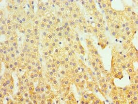 SUV39H2 Antibody (aa201-410)