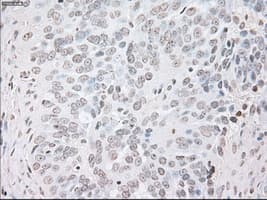 Monoclonal Mouse anti-Human GFAP Antibody (clone OTI5D7, IHC, WB)