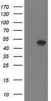 SETD7 / SET7 Antibody (clone OTI5B11)