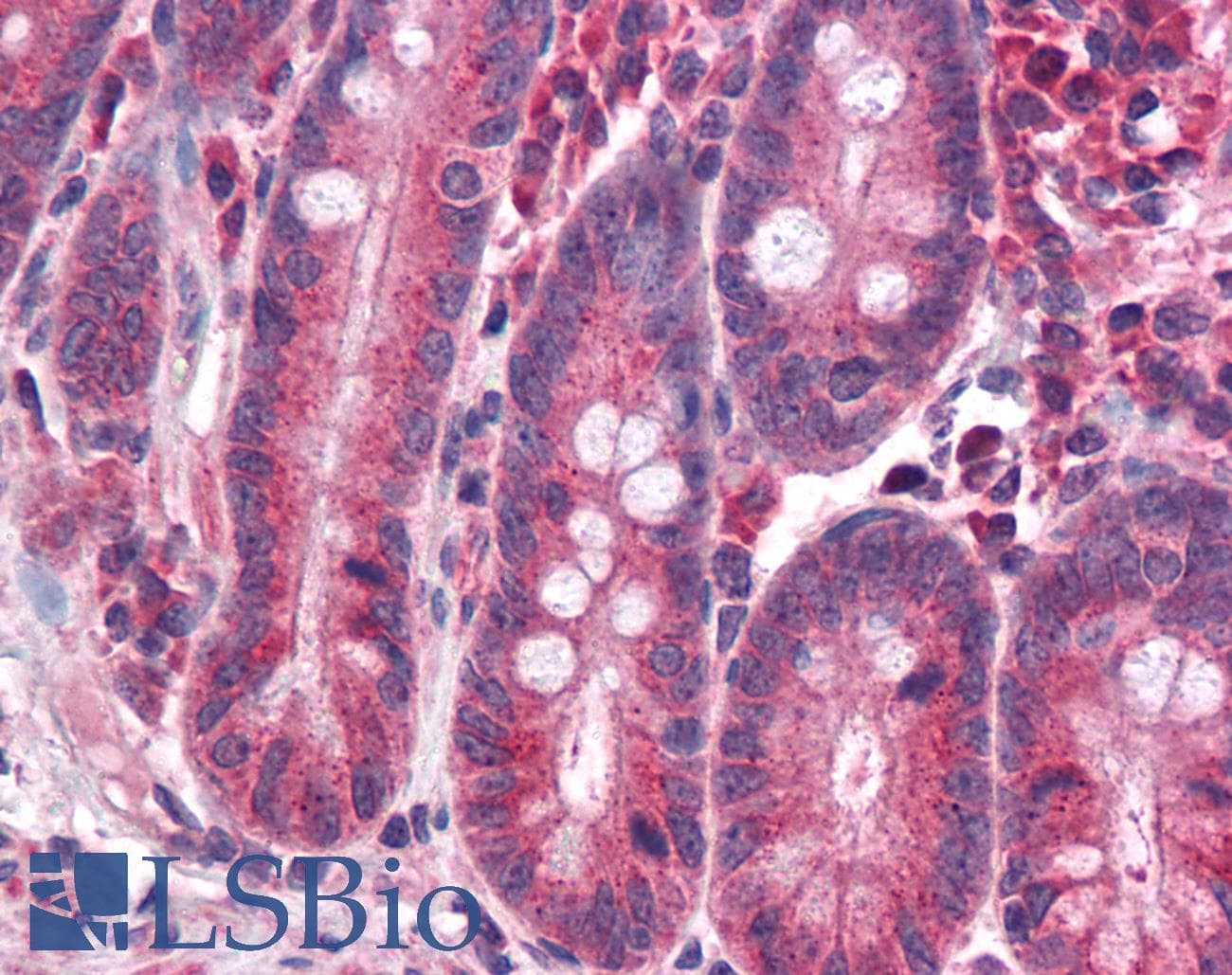IHC-plus™ NR1H3 / LXR Alpha Antibody