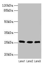 Polyclonal Rabbit anti-Human LIN7A Antibody