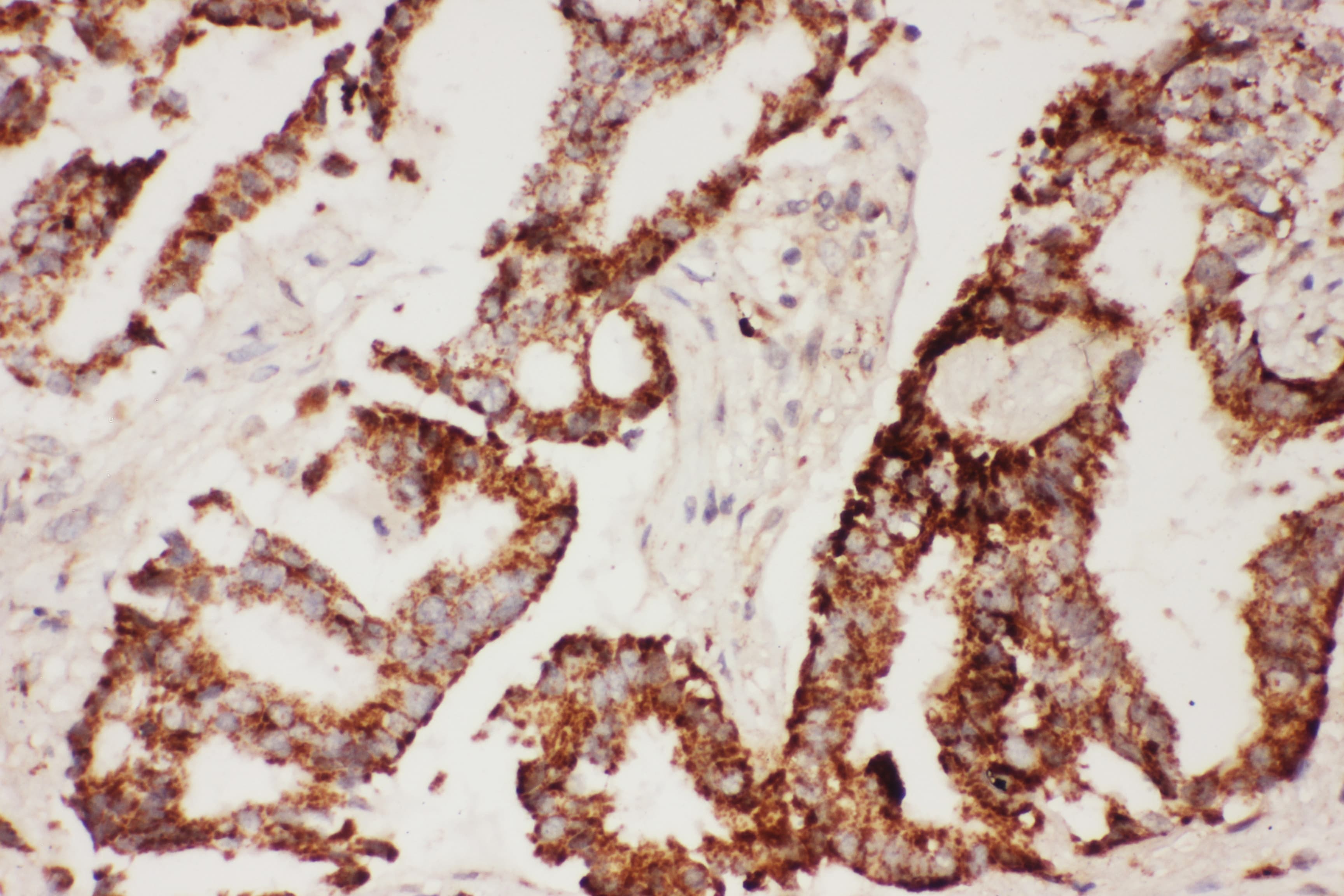 CNTF Antibody (aa2-200)