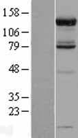 PAN2 / USP52 Protein (Over-Expression Lysate Myc-DDK (Flag))