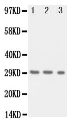 KLK1 / Kallikrein 1 Antibody (aa182-197)