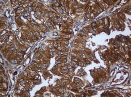 CAPN2 / Calpain 2 / M-Calpain Antibody (clone OTI3G1)