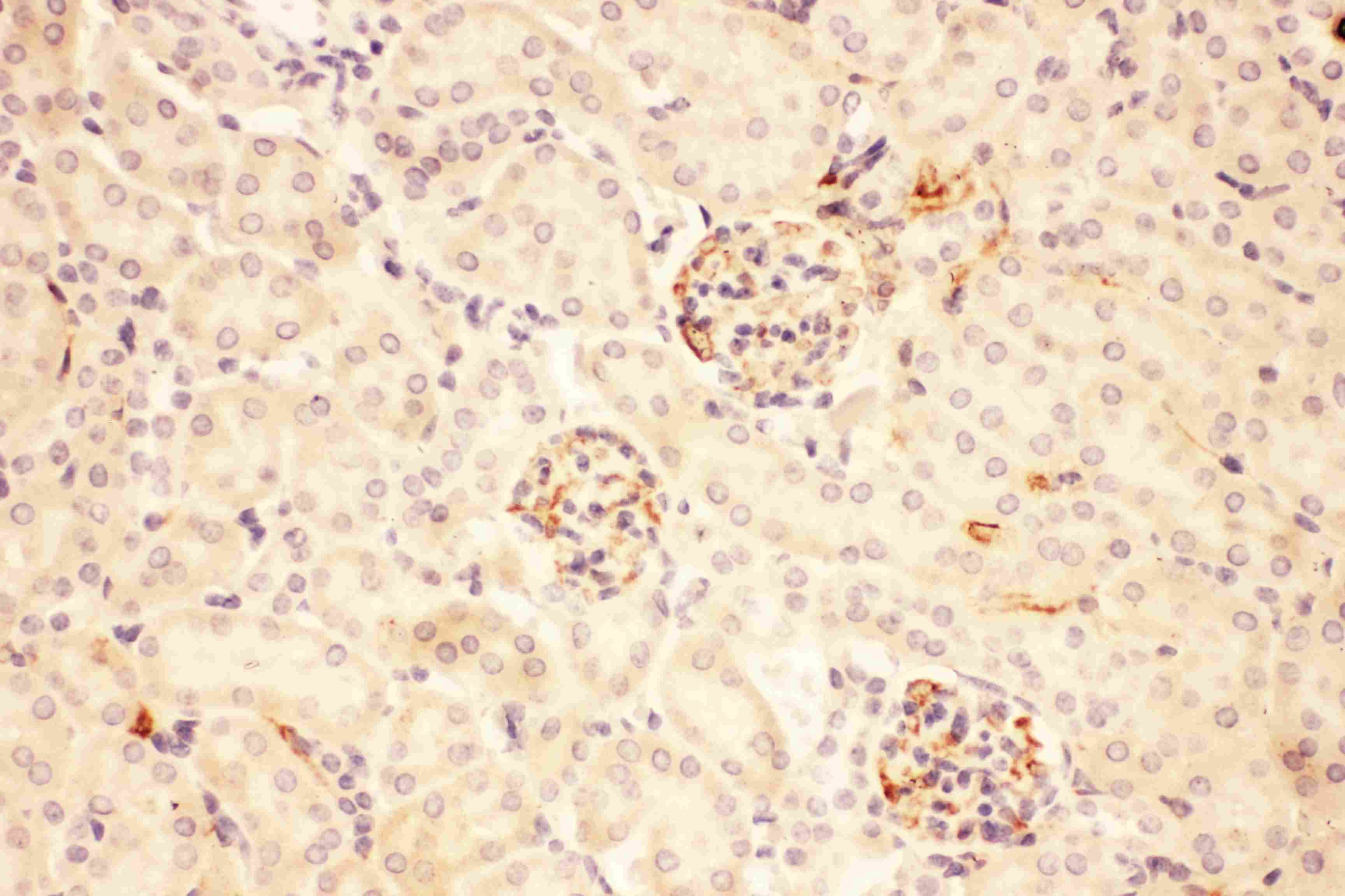 POMC / Proopiomelanocortin Antibody (aa138-176)