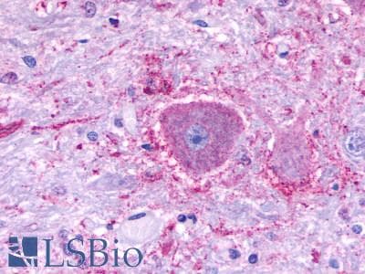 PathPlus™ Polyclonal Rabbit anti-Human NTSR2 / NTR2 Antibody (C-Terminus, IHC)