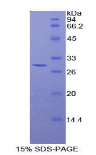 Human STC2 / Stanniocalcin 2 Protein (Recombinant His)