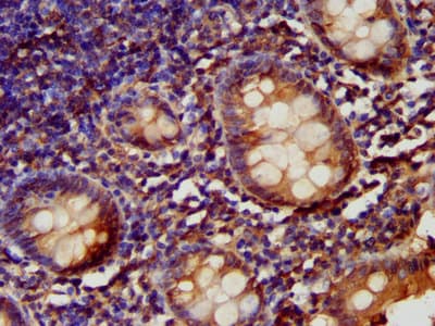Polyclonal Rabbit anti-Human LARP6 / ACHN Antibody (IHC)