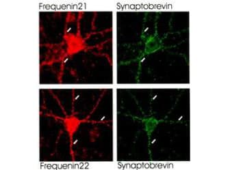 IHC-plus™ NCS1 / Neuronal Calcium Sensor Antibody