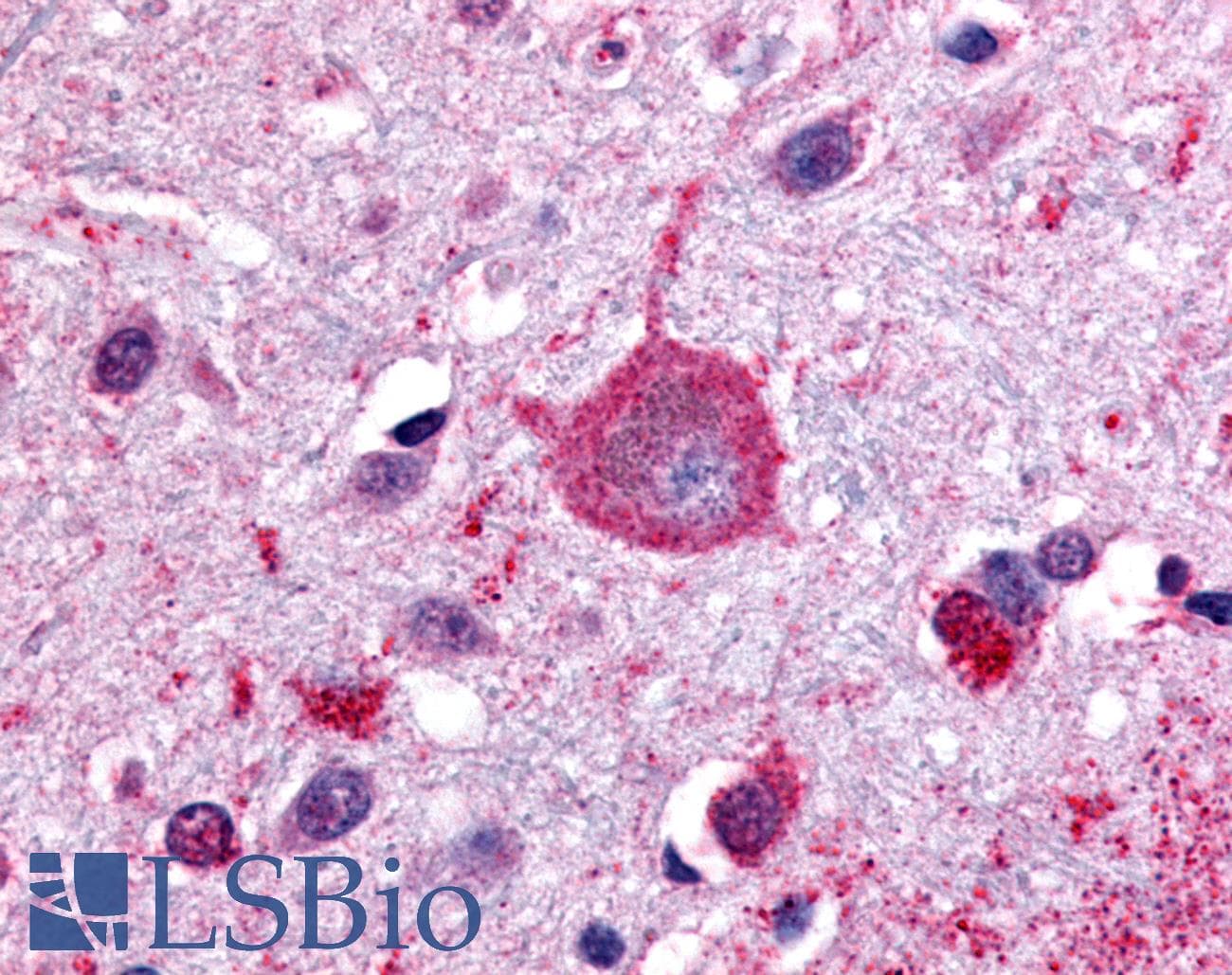 IHC-plus™ RAIG2 / GPRC5B Antibody (C-Terminus)