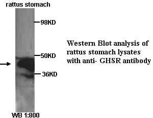 GHSR / Ghrelin Receptor Antibody (C-Terminus)