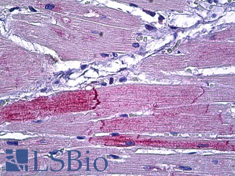 IHC-plus™ PRKD2 / PKD2 Antibody (aa829-878)