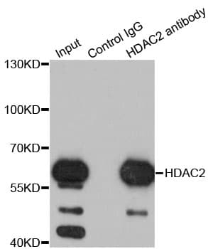 Polyclonal Rabbit anti-Human HDAC2 Antibody (IHC, IF, WB)