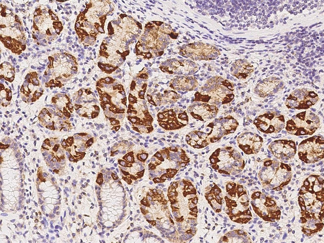 AUH Antibody