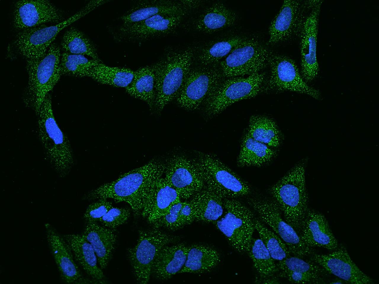 FBXW9 Antibody