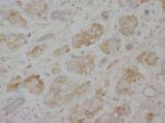 LMNA / Lamin A+C Antibody (C-Terminus)