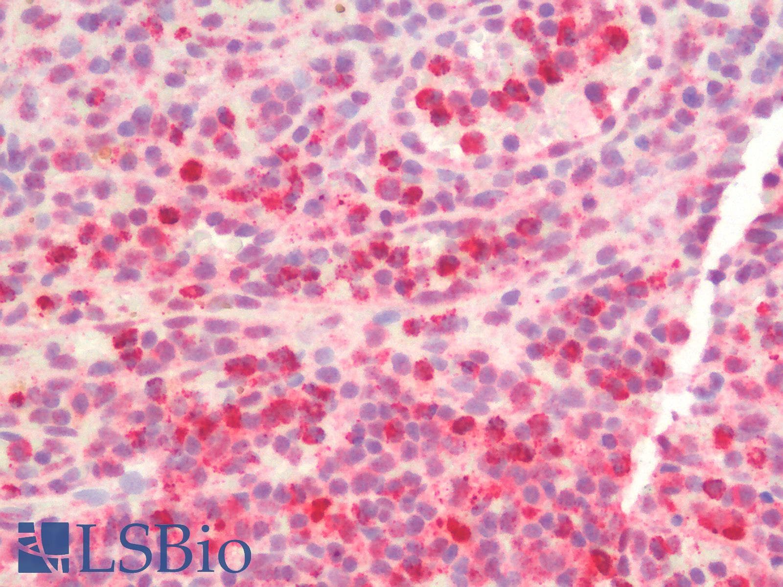 IHC-plus™ Polyclonal Rabbit anti-Mouse MPO / Myeloperoxidase Antibody (IHC, IF)