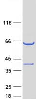 Human CCDC117 Protein (Recombinant Myc-DDK (Flag))