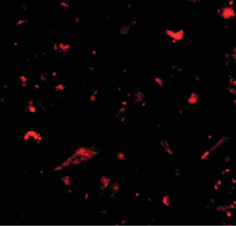 Polyclonal Rabbit anti-Human NANOS1 / NOS1 Antibody (IHC, IF, WB)