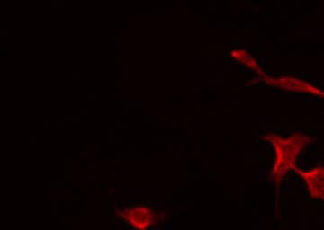 PTPRZ1 / Phosphacan Antibody