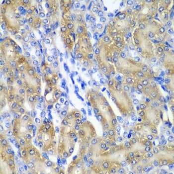CRYAA / Alpha A Crystallin Antibody