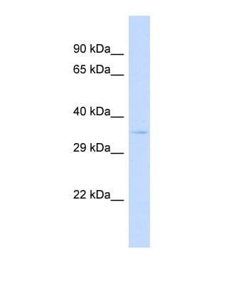 SPPL2B Antibody (aa53-102)