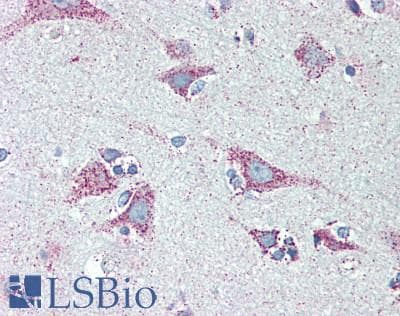 IHC-plus™ MAP2K4 / MKK4 Antibody (aa349-399)
