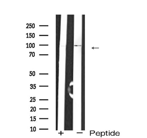 GRM6 / MGLUR6 Antibody