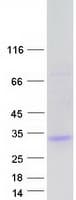 Human UNC50 Protein (Recombinant Myc-DDK (Flag))