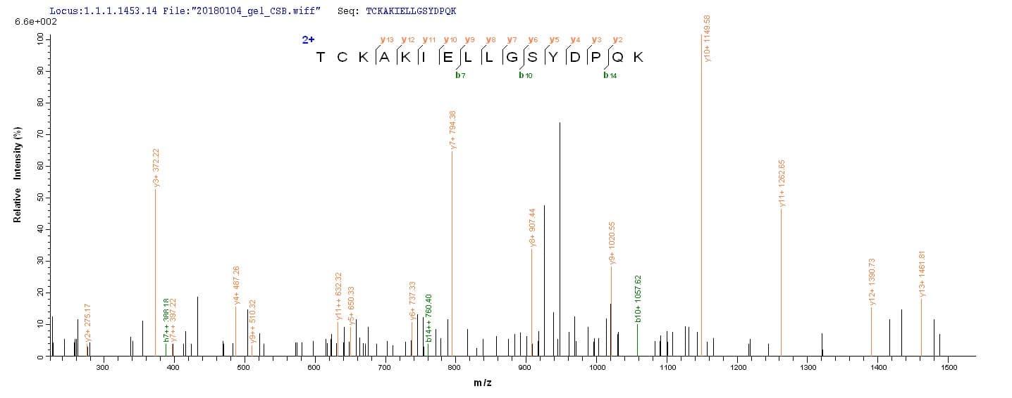 Human ACP1 / Acid Phosphatase Protein (Recombinant)