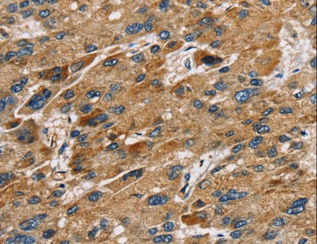 Polyclonal Rabbit anti-Human SULT1B1 / Sulfotransferase 1B1 Antibody (IHC, WB)