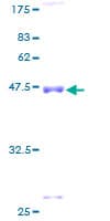 Human DR1 / NC2 Protein (Recombinant GST)