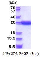 Human STARD5 Protein (Recombinant His)
