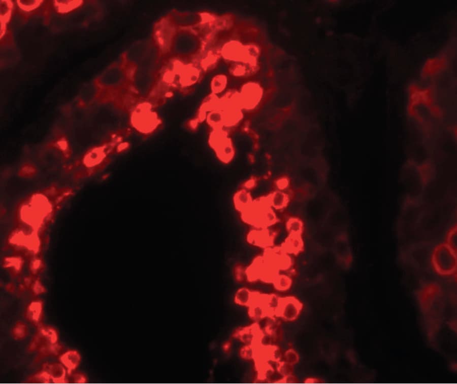 IHC-plus™ MSY2 / YBX2 Antibody