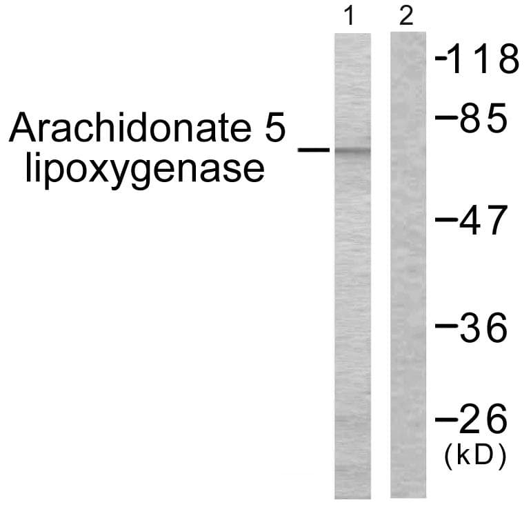 Polyclonal Rabbit anti-Human ALOX5 / 5-LOX Antibody (p271, IHC, WB)