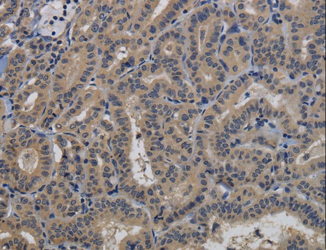 TAB1 Antibody