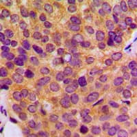 MMP19 Antibody (N-Terminus)