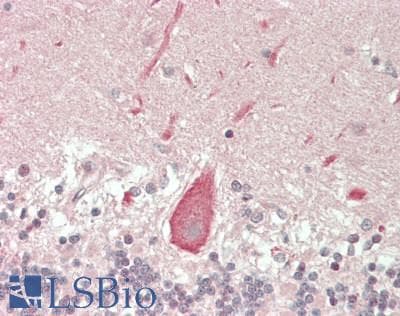 IHC-plus™ DUX4 Antibody (aa376-404)