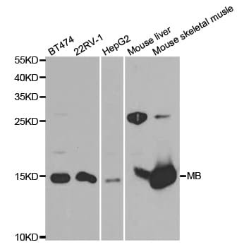 MB / Myoglobin Antibody
