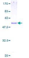 Human PGLS / 6PGL Protein (Recombinant GST)
