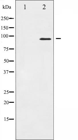 NBN / Nibrin Antibody