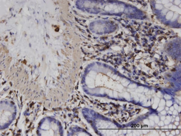 ACTRT2 Antibody (clone 2E10)