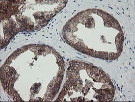 TPD52L3 Antibody (clone OTI4C12, Carrier-free)