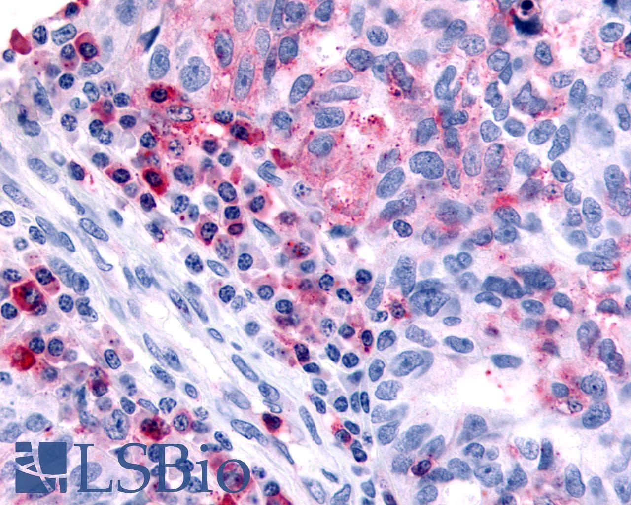 PathPlus™ HRH4 / Histamine H4 Receptor Antibody (Cytoplasmic Domain)