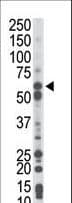 Polyclonal Rabbit anti-Human PCK1 Antibody (aa40-70, IHC, WB)