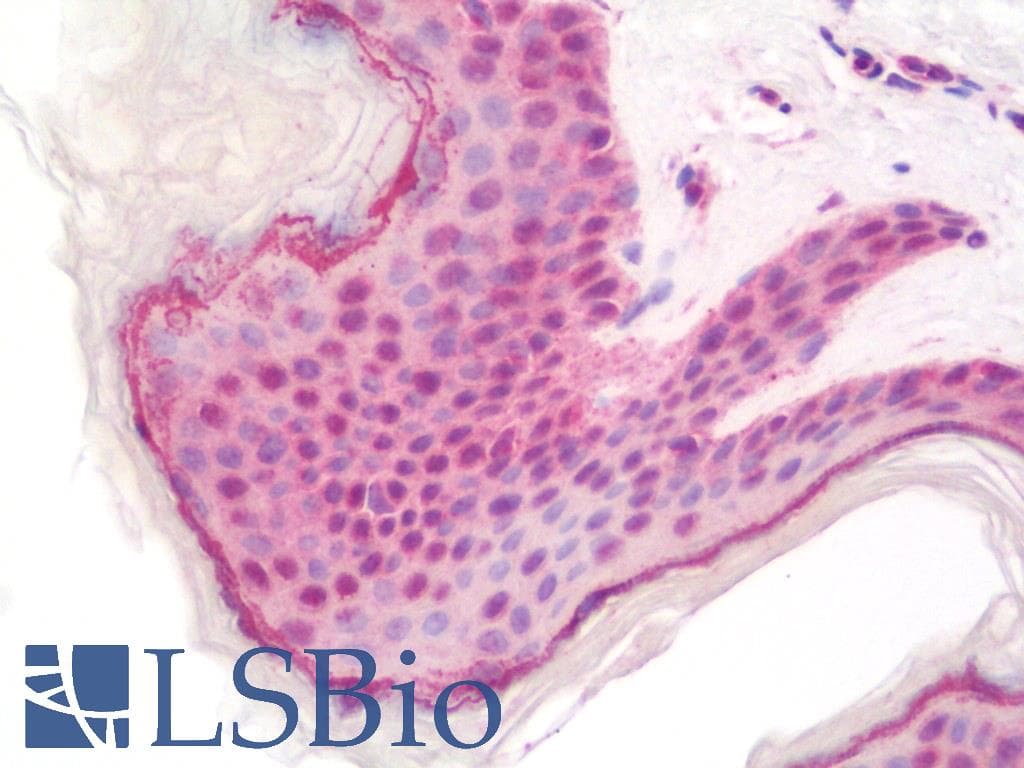 IHC-plus™ Polyclonal Rabbit anti-Human ABL1 / c-ABL Antibody (aa850-900, IHC, IF)